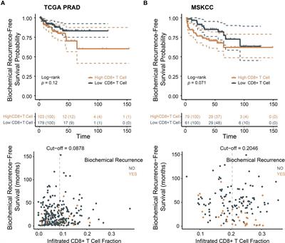 MLXIPL associated with tumor-infiltrating CD8+ T cells is involved in poor prostate cancer prognosis